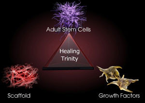 PRP Trinity